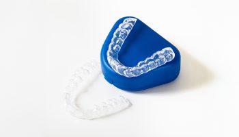 How Often Will You Need to Change Your Clear Aligners?