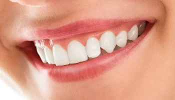How Dental Bonding Can Give Mesa Residents a Hollywood Smile?